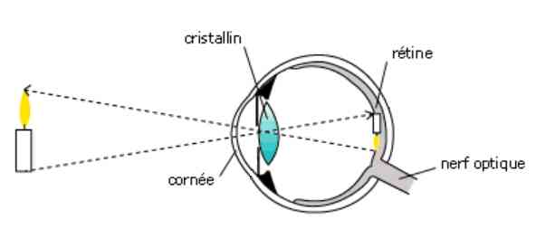 dyslexie et transformation des images par l'oeil